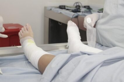 ¿Qué hacer ante una quemadura? Antioquia en alerta por 68 casos